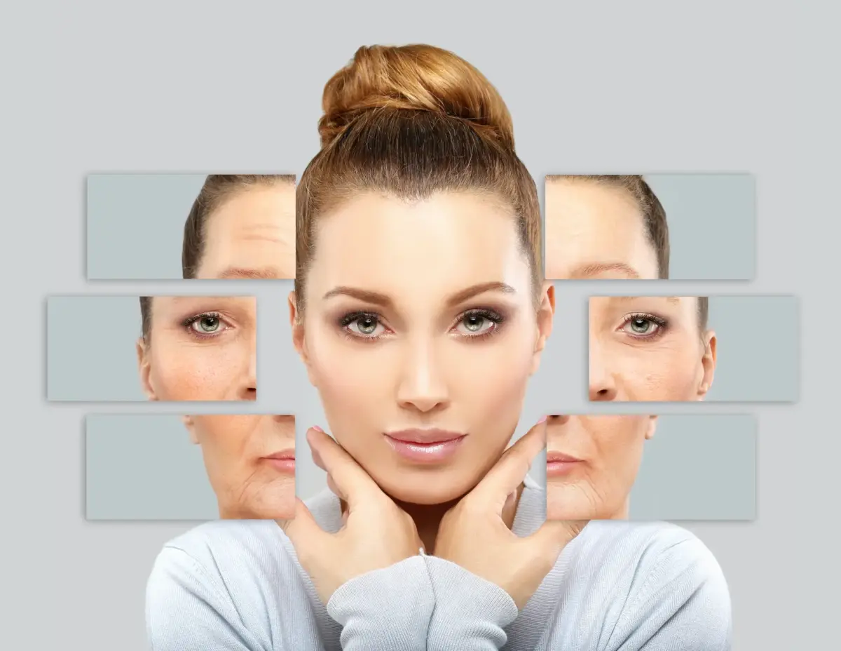 Botox and Broad Band Light for Rosacea: A Powerful Treatment