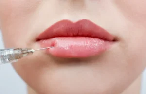 Dermal Filler Treatment in Washington, DC at Ritual