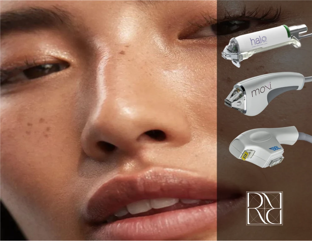 Person's face beside Sciton BBL, Moxi, and Halo laser skin treatment devices