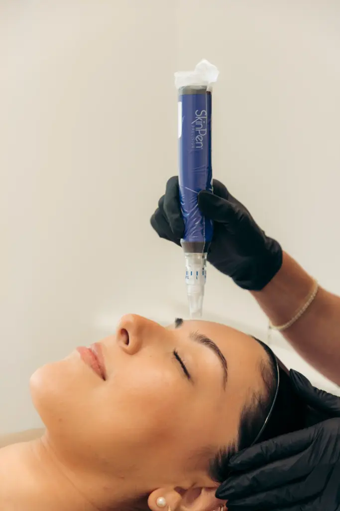 A Woman is receiving Microneedling and RF Microneedling Treatment at Ritual by Tracy Holzman NP-C in Washington, DC