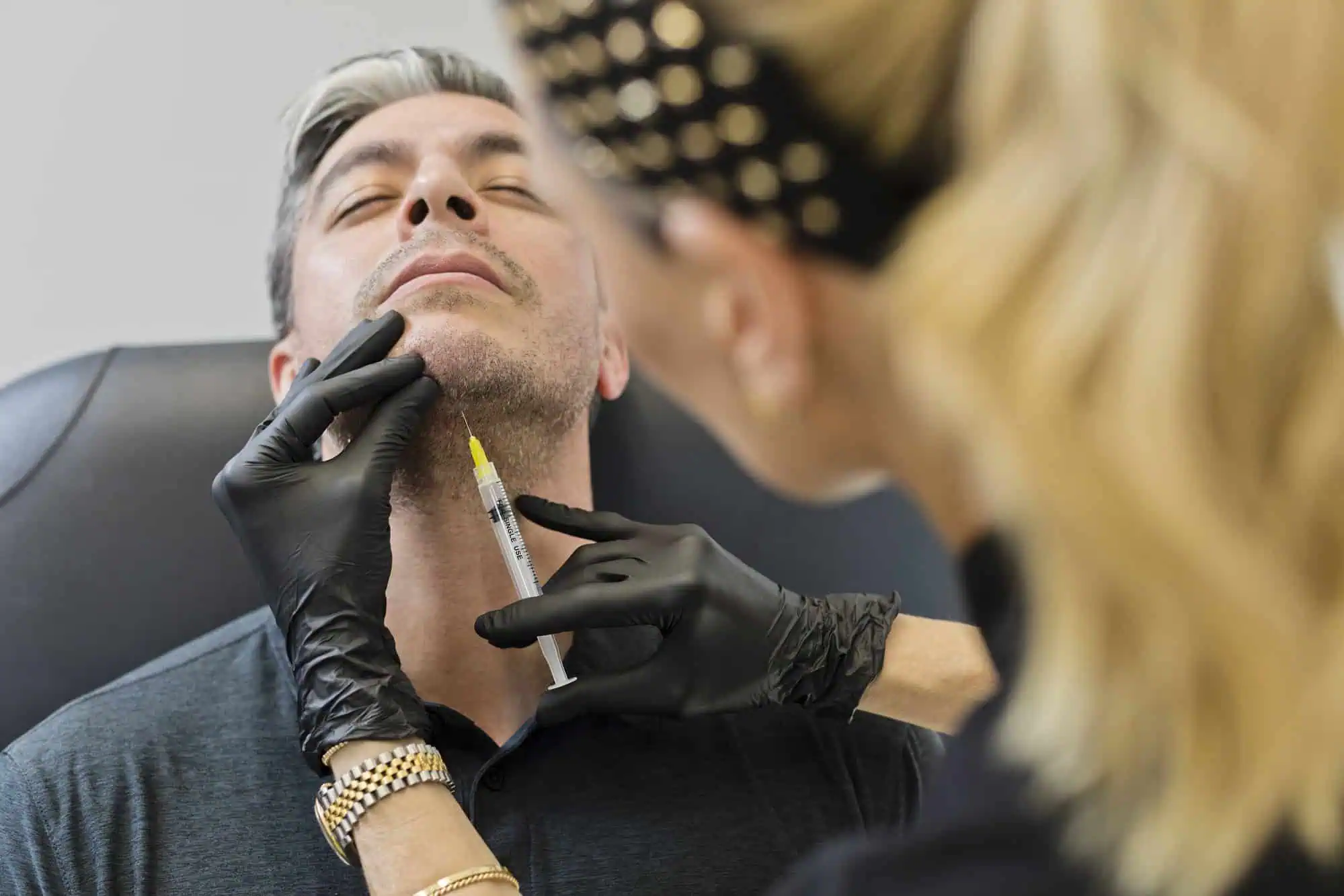 Dermal filler treatment at Ritual in Washington, DC